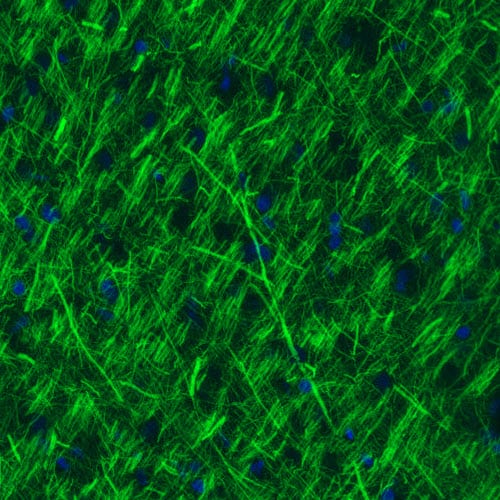 Staining of rat cerebral cortex shows strong immunoreactivity in neuronal processes.