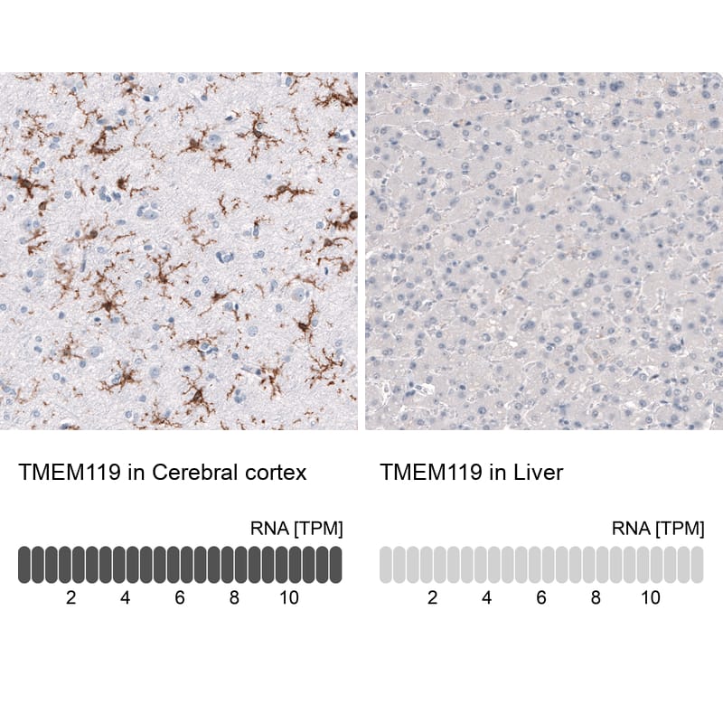 Analysis in human cerebral cortex and liver tissues using NBP3-43823 antibody. Corresponding TMEM119 RNA-seq data are presented for the same tissues.