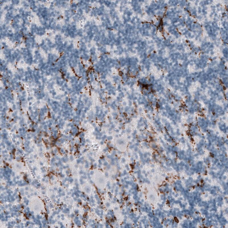 Staining of human cerebellum shows strong membranous positivity in microglia.