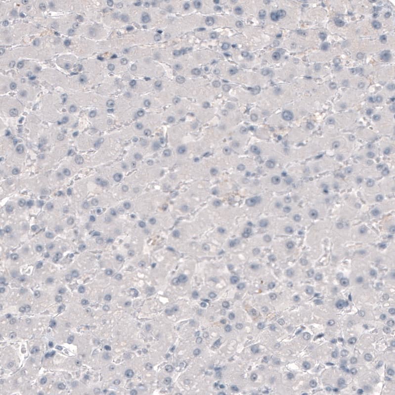 Staining of human liver shows no positivity in hepatocytes as expected.