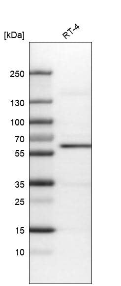 Analysis in human cell line RT-4.