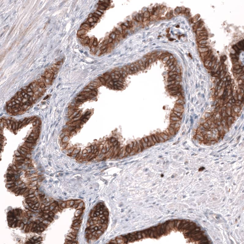 Staining of human prostate shows strong membranous positivity in glandular cells.
