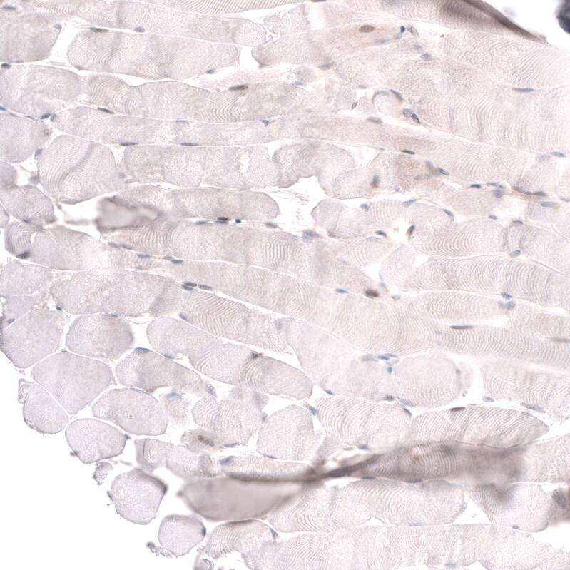 Staining of human skeletal muscle shows no positivity in myocytes as expected.