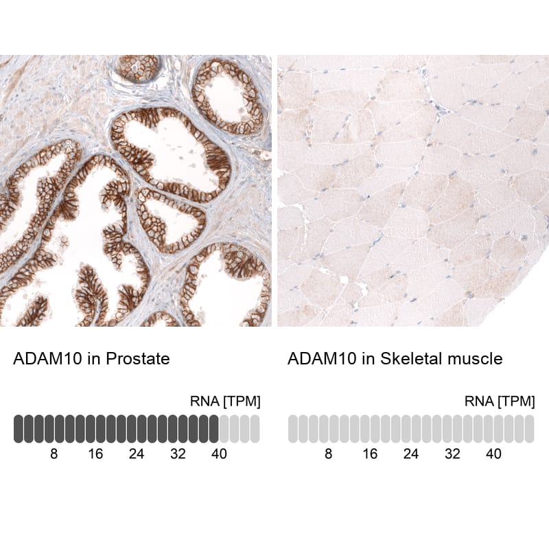 Analysis in human prostate and skeletal muscle tissues using NBP3-43827 antibody. Corresponding ADAM10 RNA-seq data are presented for the same tissues.