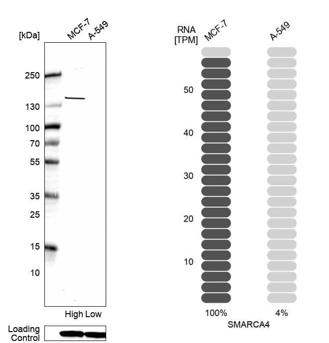 Analysis in human cell lines MCF-7 and A-549 using Anti-Brg1 antibody. Corresponding Brg1 RNA-seq data are presented for the same cell lines. Loading control: Anti-HSP90B1.