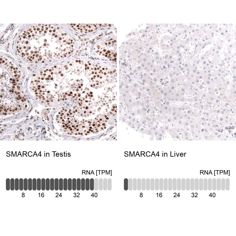 Analysis in human testis and liver tissues using NBP3-43830 antibody. Corresponding Brg1 RNA-seq data are presented for the same tissues.