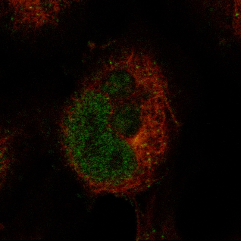 Staining in NTERA-2 cell line with Anti-Ctip1 monoclonal antibody) .