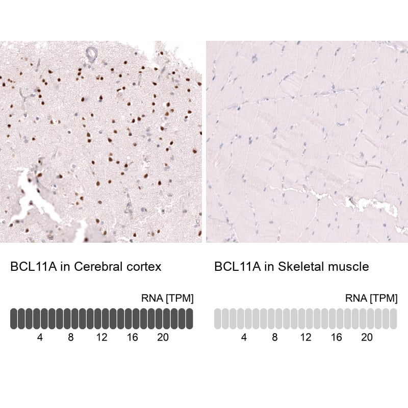 Analysis in human cerebral cortex and skeletal muscle tissues using NBP3-43832 antibody. Corresponding Ctip1 RNA-seq data are presented for the same tissues.