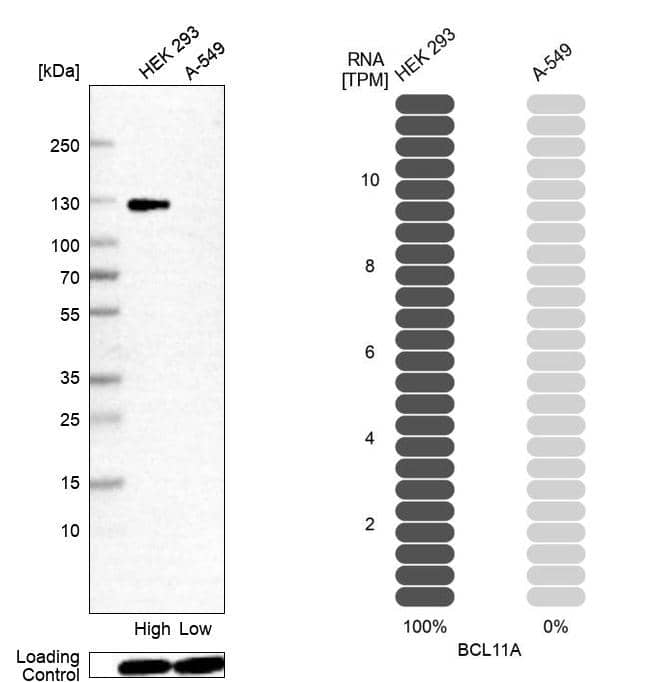 Analysis in human cell lines HEK293 and A-549 using Anti-Ctip1 antibody. Corresponding Ctip1 RNA-seq data are presented for the same cell lines. Loading control: Anti-HSP90B1.