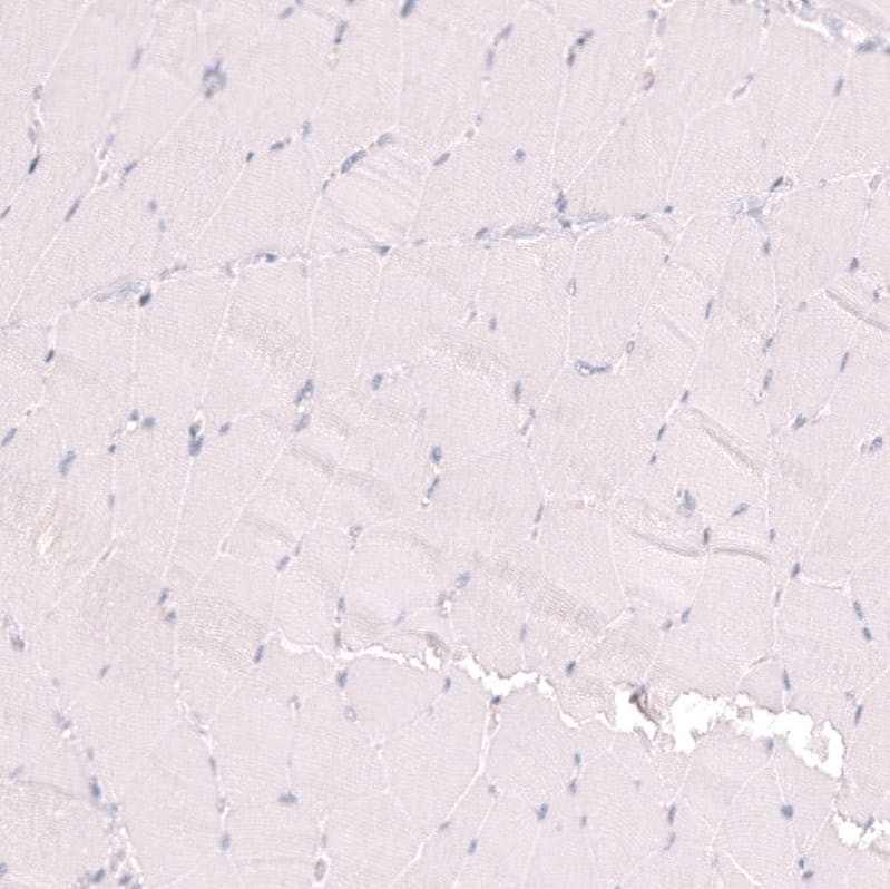 Staining of human skeletal muscle shows no positivity in myocytes as expected.