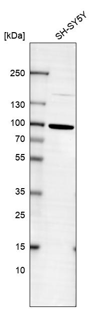 Analysis in human cell line SH-SY5Y.