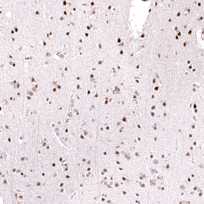 Staining of human cerebral cortex shows strong nuclear positivity in neurons.