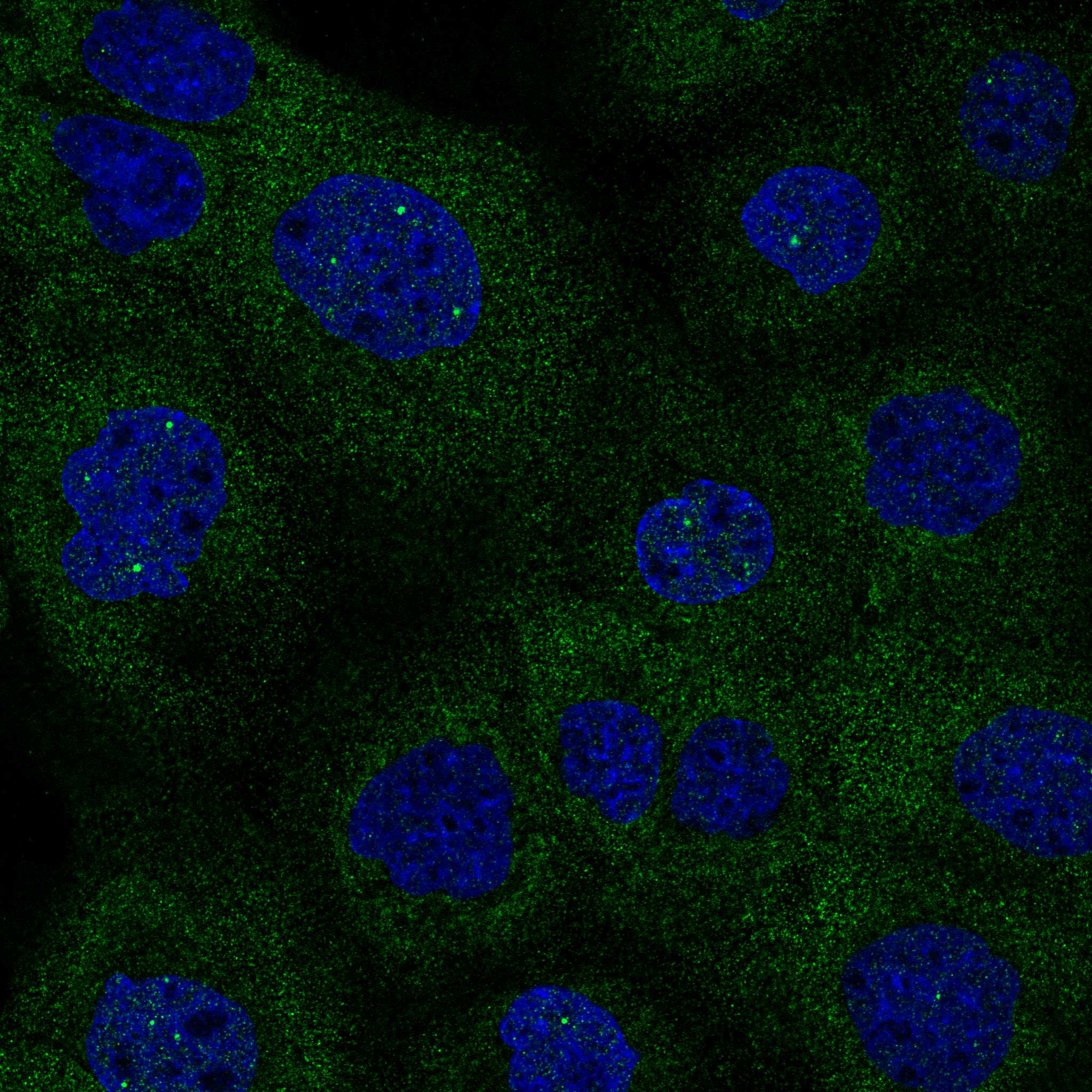 Staining of A-431 cells, showing specific staining in the cytosol and nuclear bodies in green. Microtubule- and nuclear probes are visualized in red and blue, respectively (where available).
