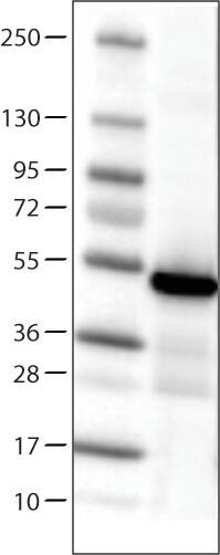 Lane 1: Marker [kDa]Lane 2: Human cell line RT-4