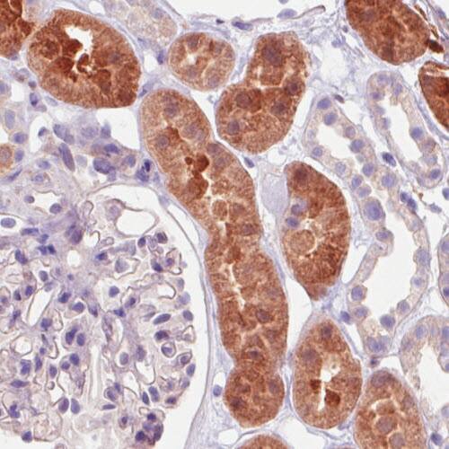Staining of human kidney shows strong positivity in a subset of renal tubules.