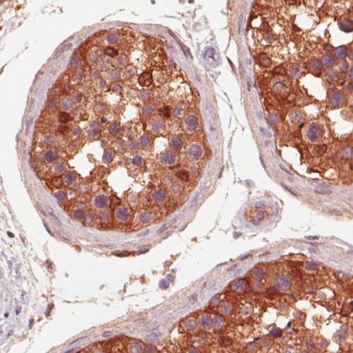 Staining of human testis shows strong immunoreactivity in seminiferous tubules.