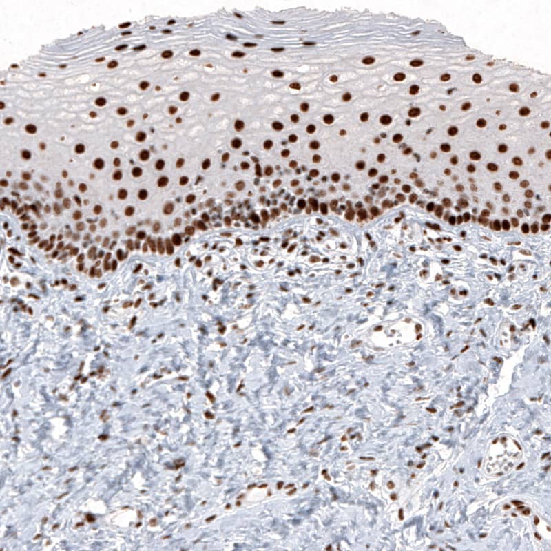 Staining of human cervix shows strong nuclear positivity in squamous epithelial cells and in connective tissue cells.