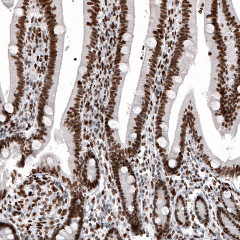Staining of human duodenum shows strong nuclear immunoreactivity in glandular cells and in lamina propria cells.
