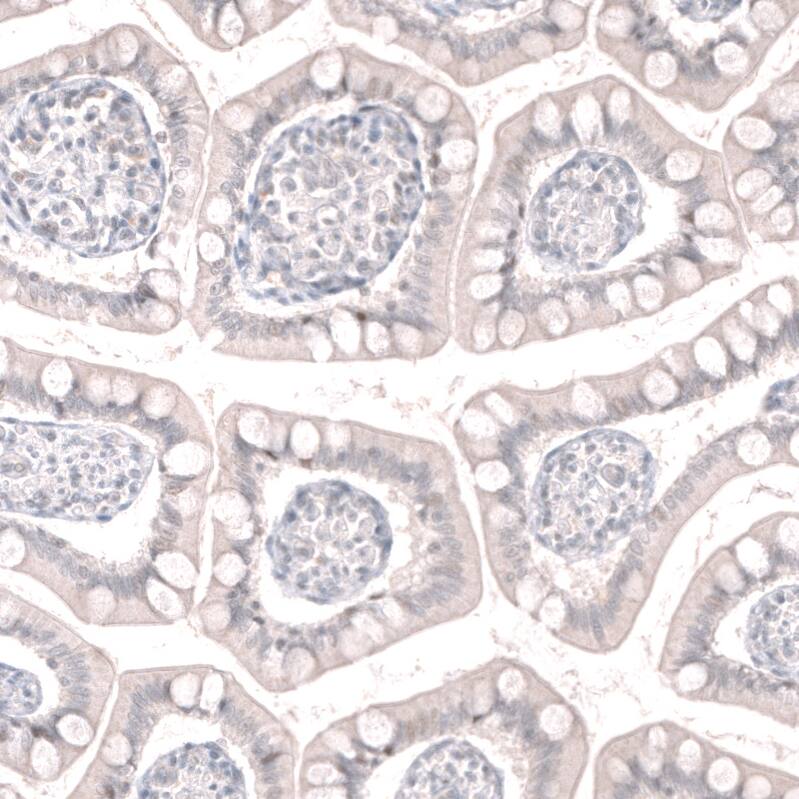 Staining of human small intestine shows no positivity in glandular cells as expected.