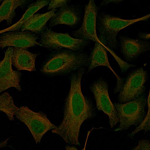 Staining in U2OS cell line with Anti-GREB1 monoclonal antibody) .