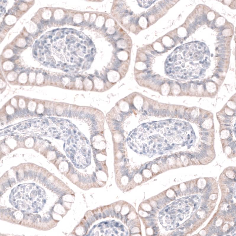 Staining of human small intestine shows no positivity in glandular cells as expected.
