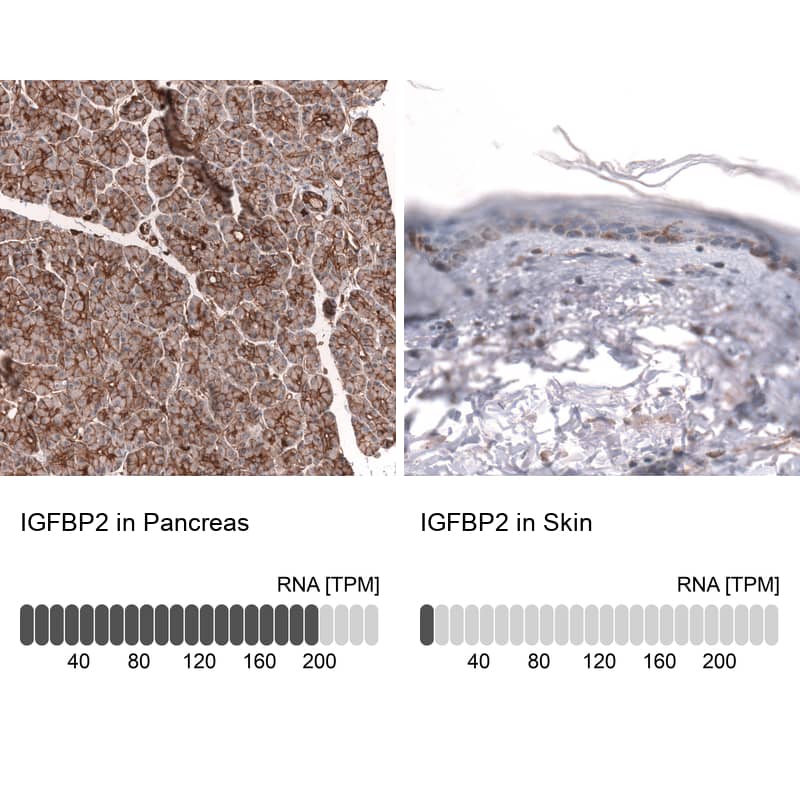 Analysis in human pancreas and skin tissues using NBP3-43841 antibody. Corresponding IGFBP-2 RNA-seq data are presented for the same tissues.