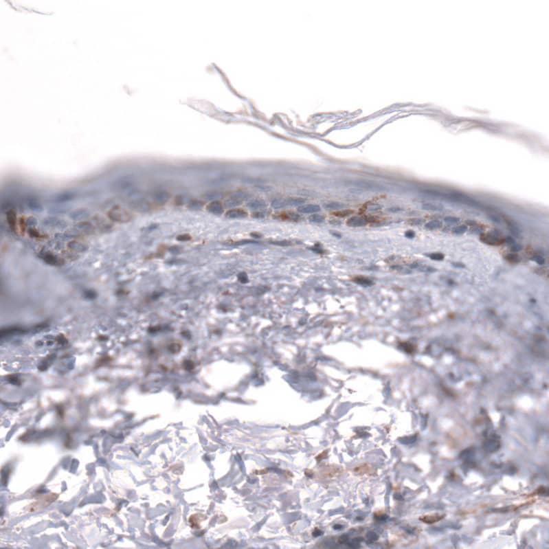 Staining of human skin shows negative to weak positivity in squamous epithelial cells.