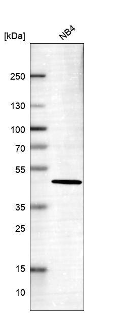 Analysis in human cell line NB4.