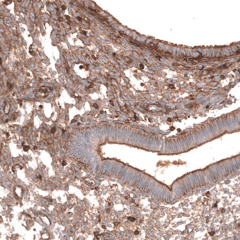 Staining of human endometrium shows moderate membranous positivity in glandular cells and endometrial stromal cells.
