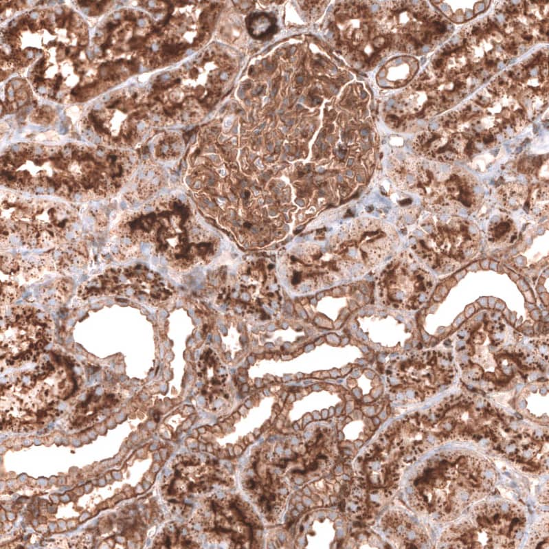 Staining of human kidney shows strong membranous positivity in cells in tubules and cells in glomeruli with additional cytoplasmic positivity.