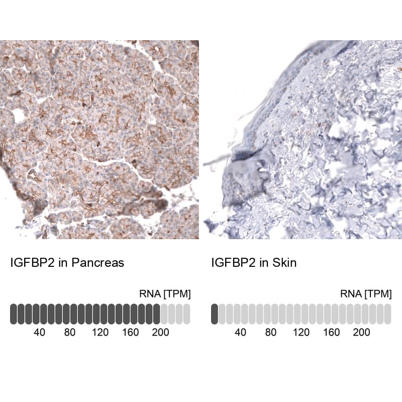Analysis in human pancreas and skin tissues using NBP3-43842 antibody. Corresponding IGFBP-2 RNA-seq data are presented for the same tissues.