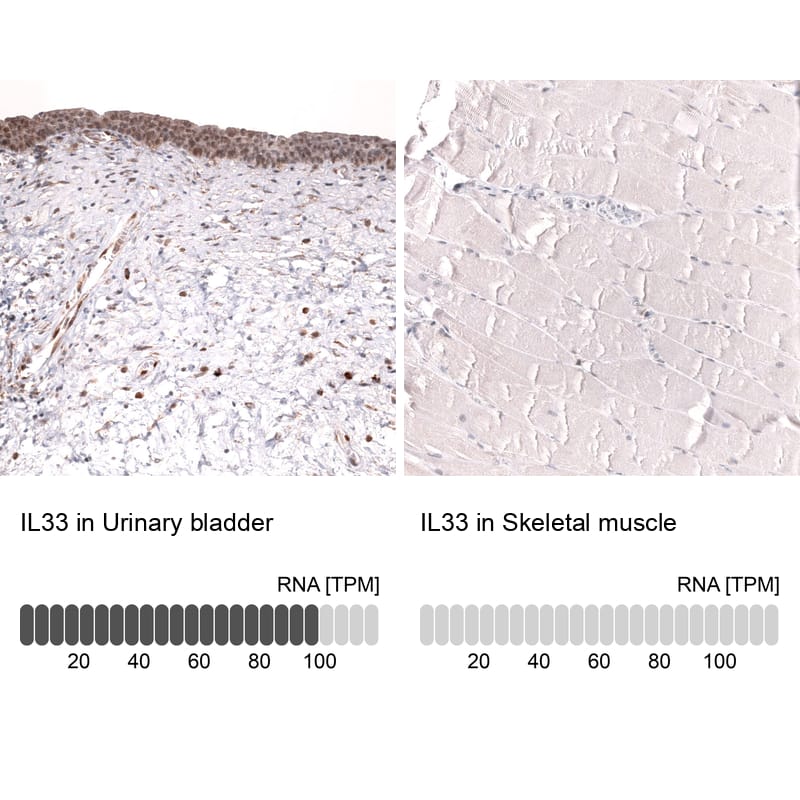 Analysis in human urinary bladder and skeletal muscle tissues using NBP3-43843 antibody. Corresponding IL-33 RNA-seq data are presented for the same tissues.