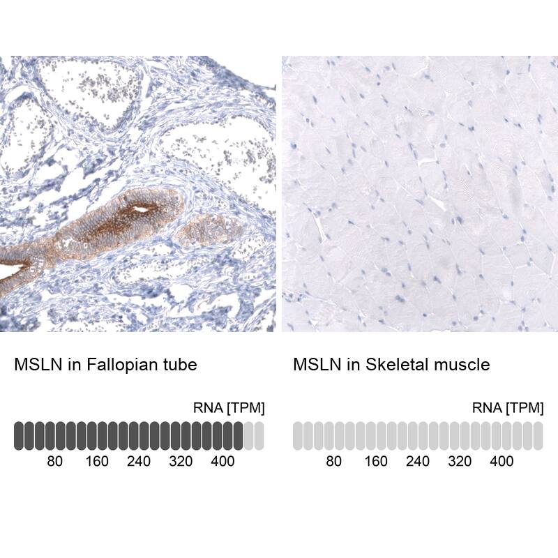 Analysis in human fallopian tube and skeletal muscle tissues using NBP3-43845 antibody. Corresponding Mesothelin RNA-seq data are presented for the same tissues.