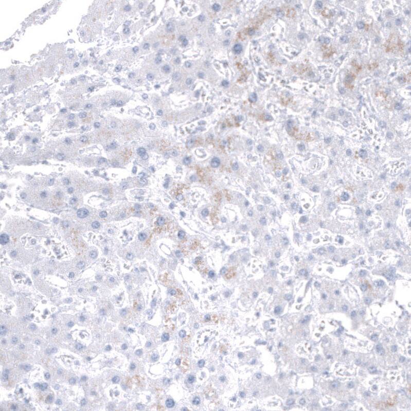 Staining of human liver shows no positivity in hepatocytes as expected.