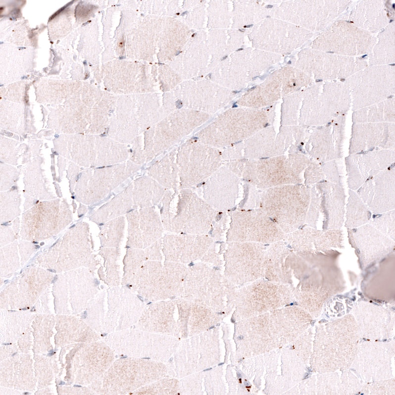 Staining of human skeletal muscle shows no nuclear positivity in myocytes as expected.