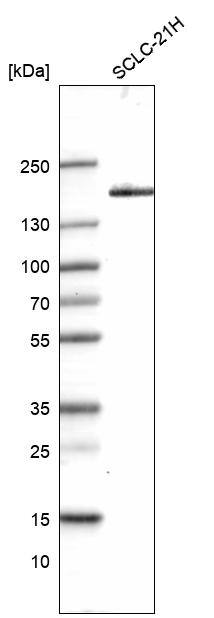 Analysis in human cell line SCLC-21H.