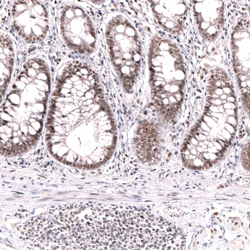 Staining of human rectum shows moderate nuclear positivity in glandular cells.