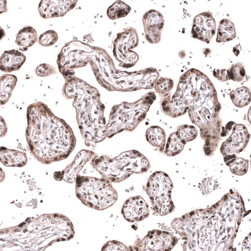 Staining of human placenta shows moderate to strong nuclear positivity in trophoblastic cells.