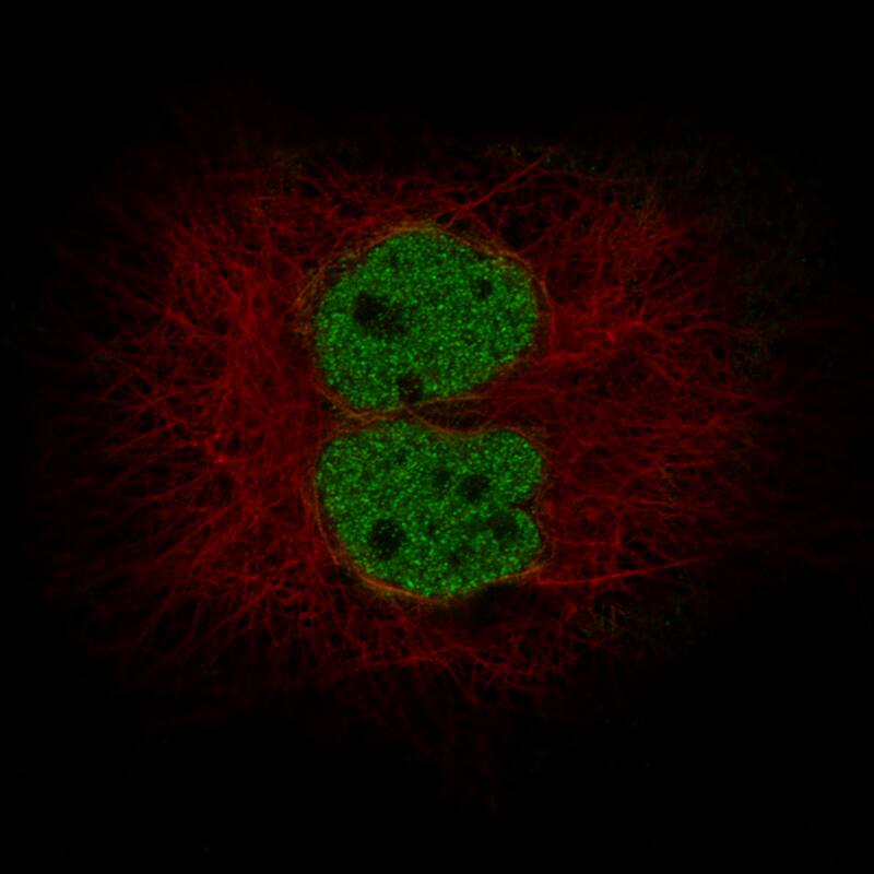 Staining in A-431 cell line with Anti-MLH3 monoclonal antibody) .
