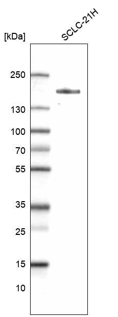 Analysis in human cell line SCLC-21H.
