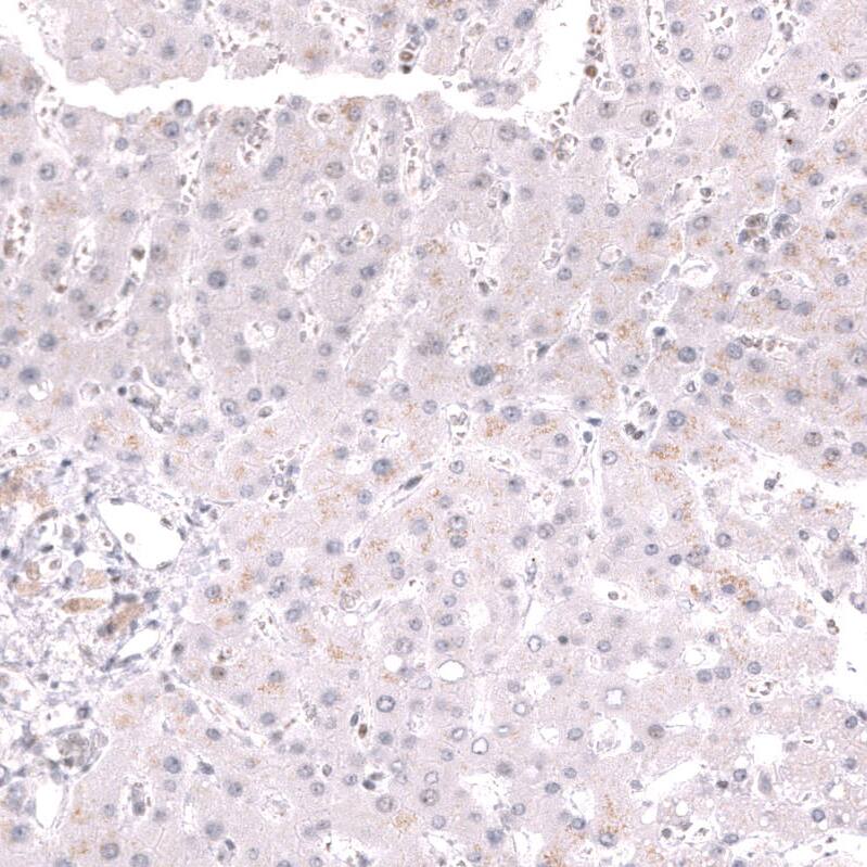 Staining of human liver shows no nuclear positivity in hepatocytes as expected.
