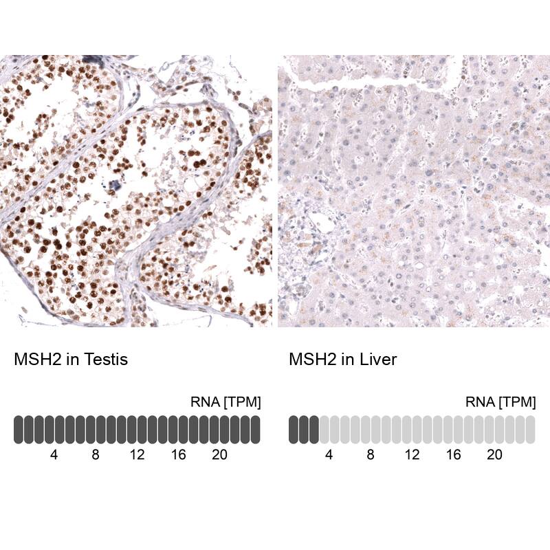 Analysis in human testis and liver tissues using NBP3-43851 antibody. Corresponding MSH2 RNA-seq data are presented for the same tissues.