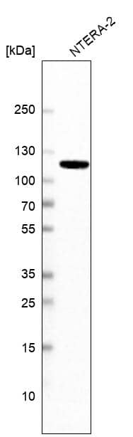 Analysis in human cell line NTERA-2.