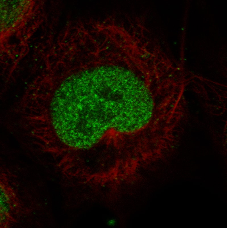Staining in NTERA-2 cell line with Anti-MSH2 monoclonal antibody) .
