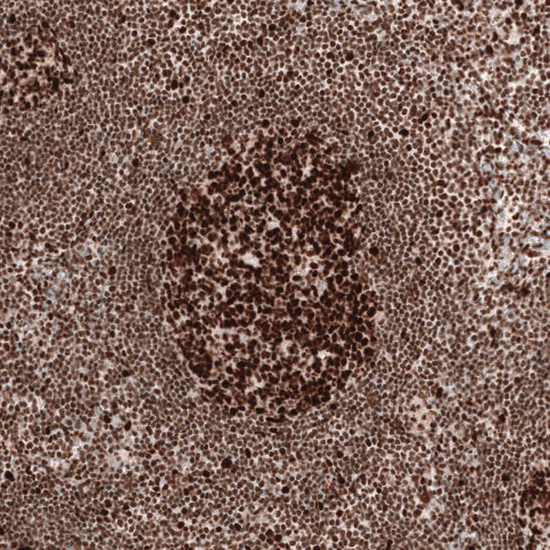 Staining of human lymph node shows strong nuclear positivity in germinal center cells.