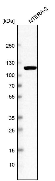 Analysis in human cell line NTERA-2.