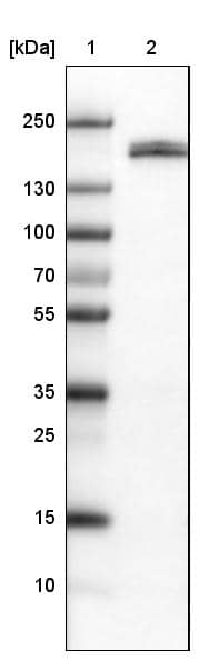 Lane 1: Marker [kDa]Lane 2: Human kidney tissue lysate