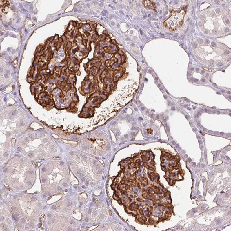 Staining of human kidney shows strong membranous positivity in cells in glomeruli, as well as endothelial cells.