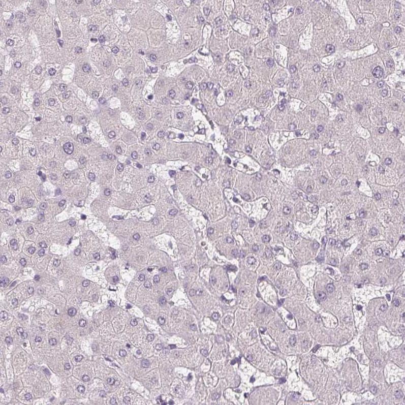 Staining of human liver shows no positivity in hepatocytes as expected.