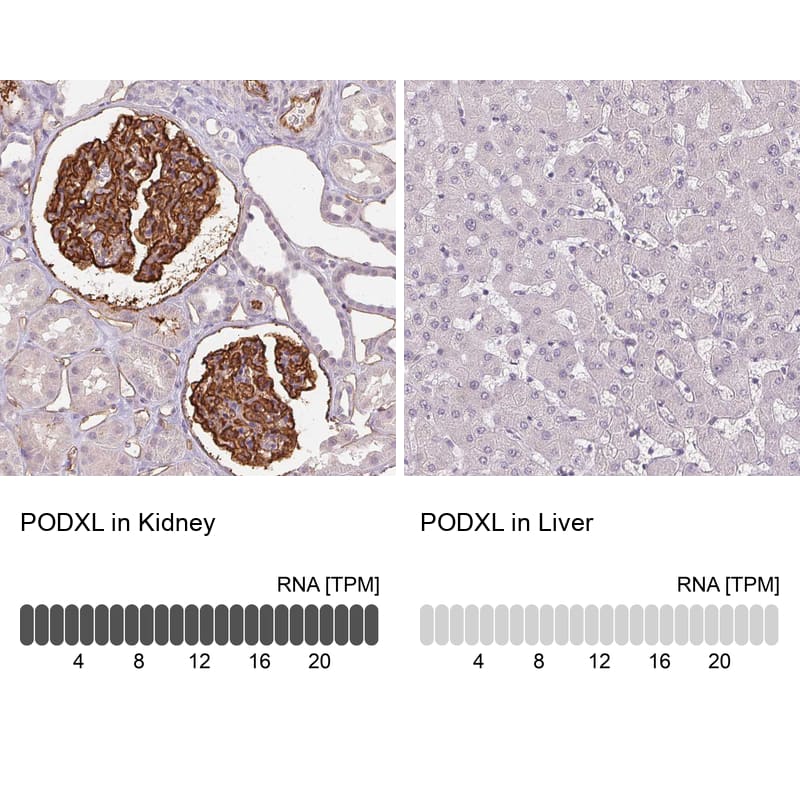 Analysis in human kidney and liver tissues using NBP3-43854 antibody. Corresponding Podocalyxin Like RNA-seq data are presented for the same tissues.